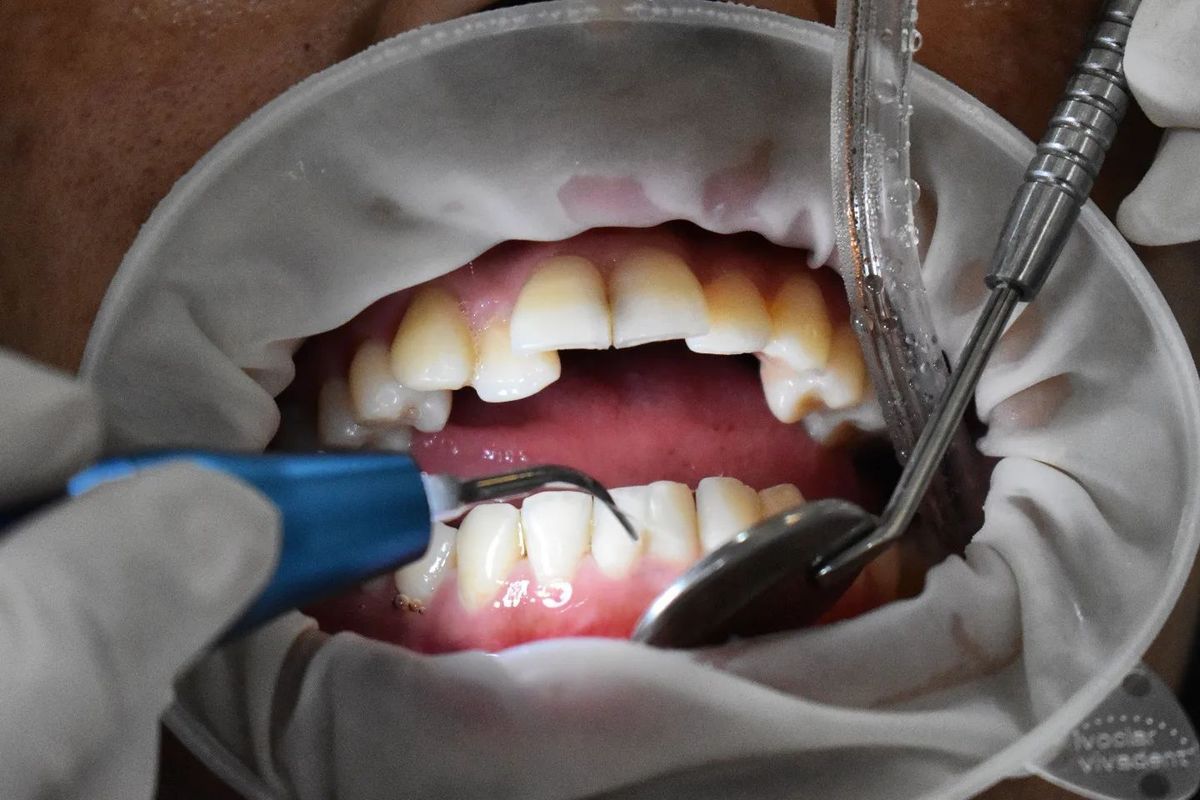 General Dentistry